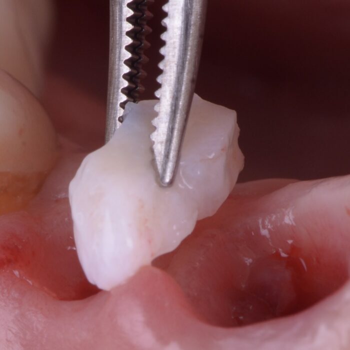 Tissus mous et implants 5 et 6 février 2026