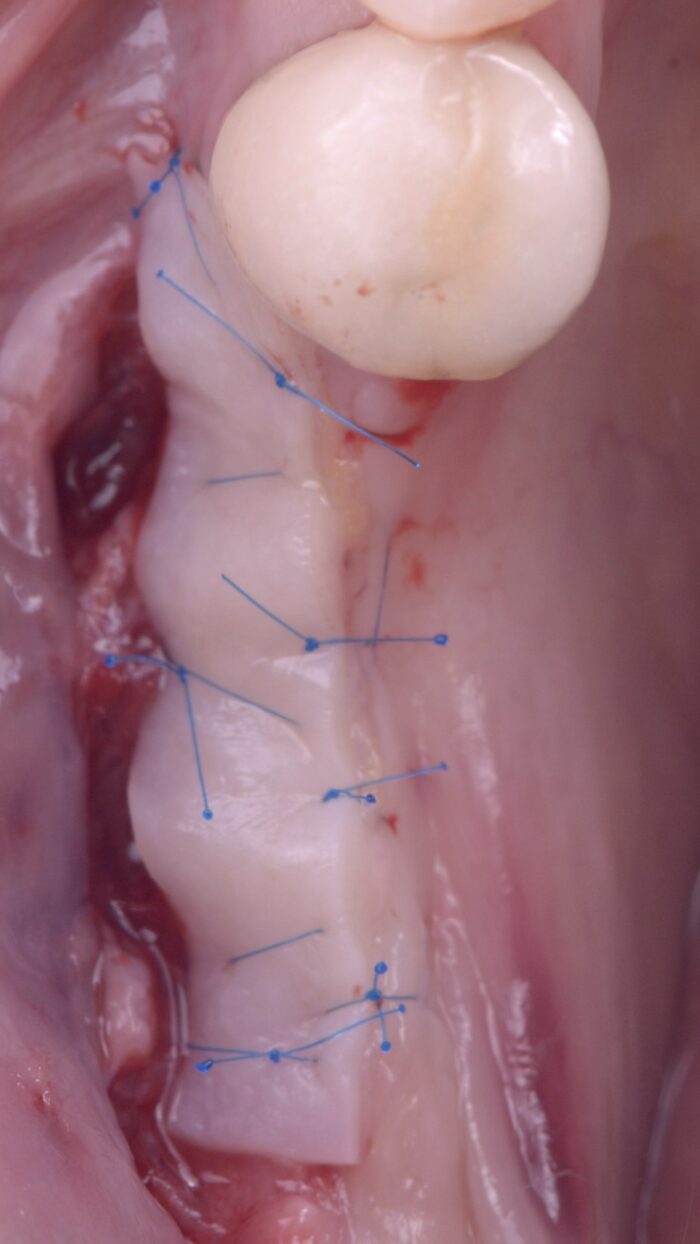 Tissus mous et implants 5 et 6 février 2026 – Image 4