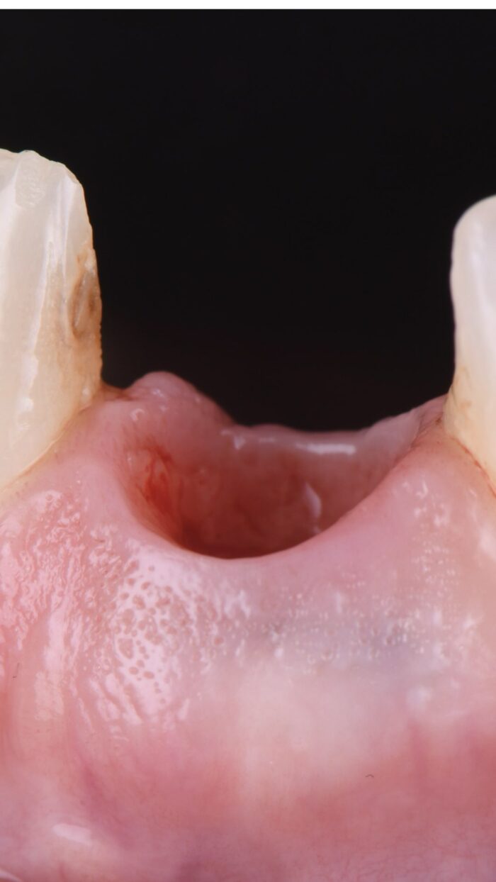 Tissus mous et implants 5 et 6 février 2026 – Image 7