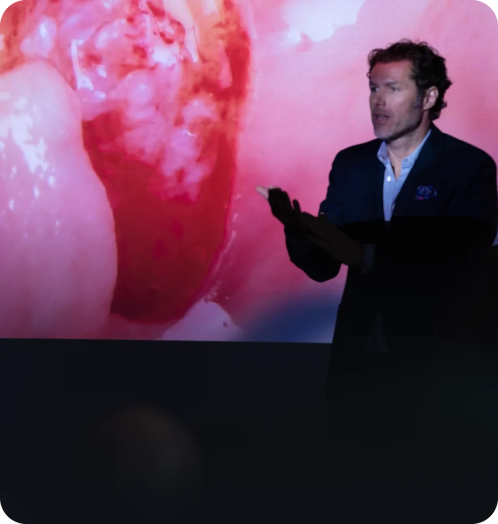 PRISM Masterclass — Reconstruction prévisible de la morphologie des tissus mous interproximaux